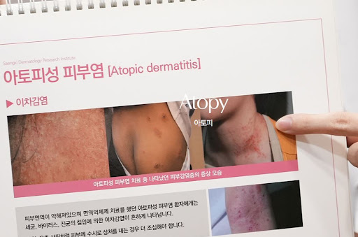 생기한의원 아토피 페이지에서 다루는 가피 증상 기본 정보